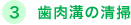 3.歯肉溝の清掃